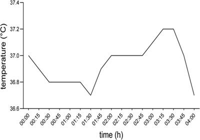 Case report: Perioperative management of a patient with shapiro syndrome during on-pump cardiac surgery